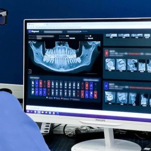 בינה מלאכותית ע''י מערכת דיאגנוקאט - תלת מיימד