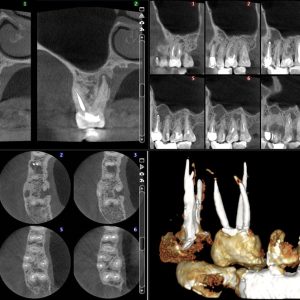 דו''ח חתכים CBCT