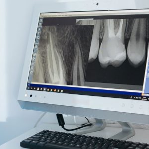 בינה מלאכותית ע''י מערכת דיאגנוקאט - דו מיימד